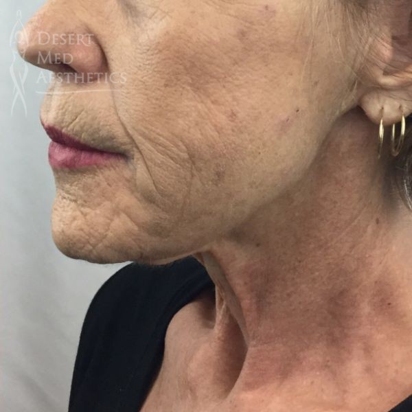 after NovaThreads left profile view