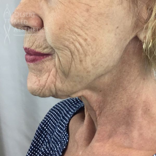 before NovaThreads left profile view