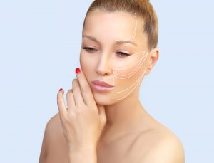 Thread Lift Is the New Facelift